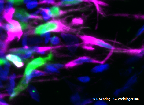 Ganzpräparat einer transgenen Flosse, in der eine Teilpopulation der Osteoblasten GFP exprimiert (grün).