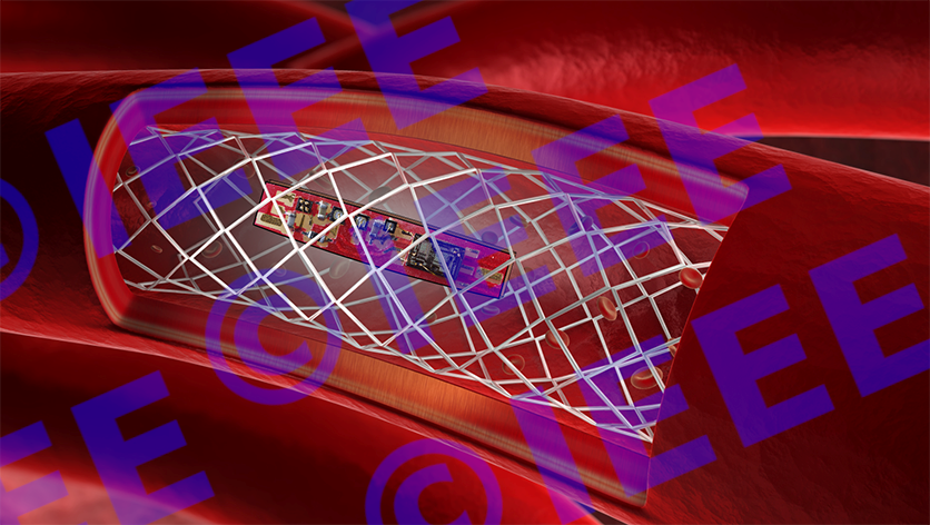 Conceptual architecture of an active stent