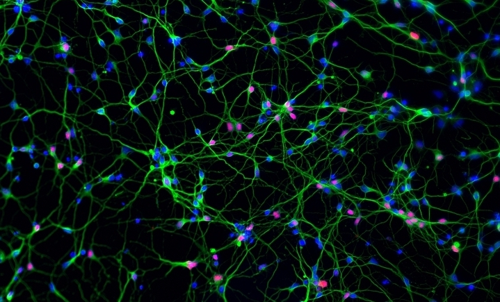 Cortical neurons