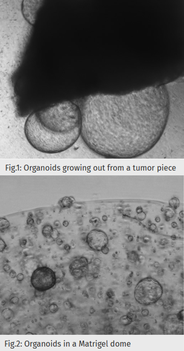 Establishment of organoid cultures The figure shows an example of the establishment of organoid cultures.